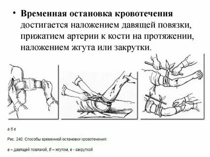 Наложение повязки при кровотечении алгоритм