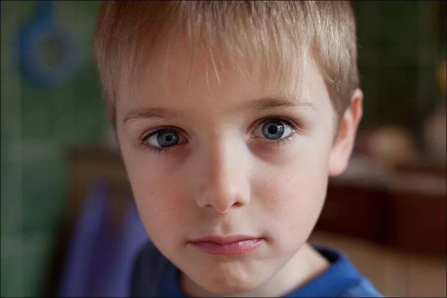 Гетерохромия и анизокория. Дети с разноцветными глазами. Мальчик с разными глазами. Глаза мальчика.