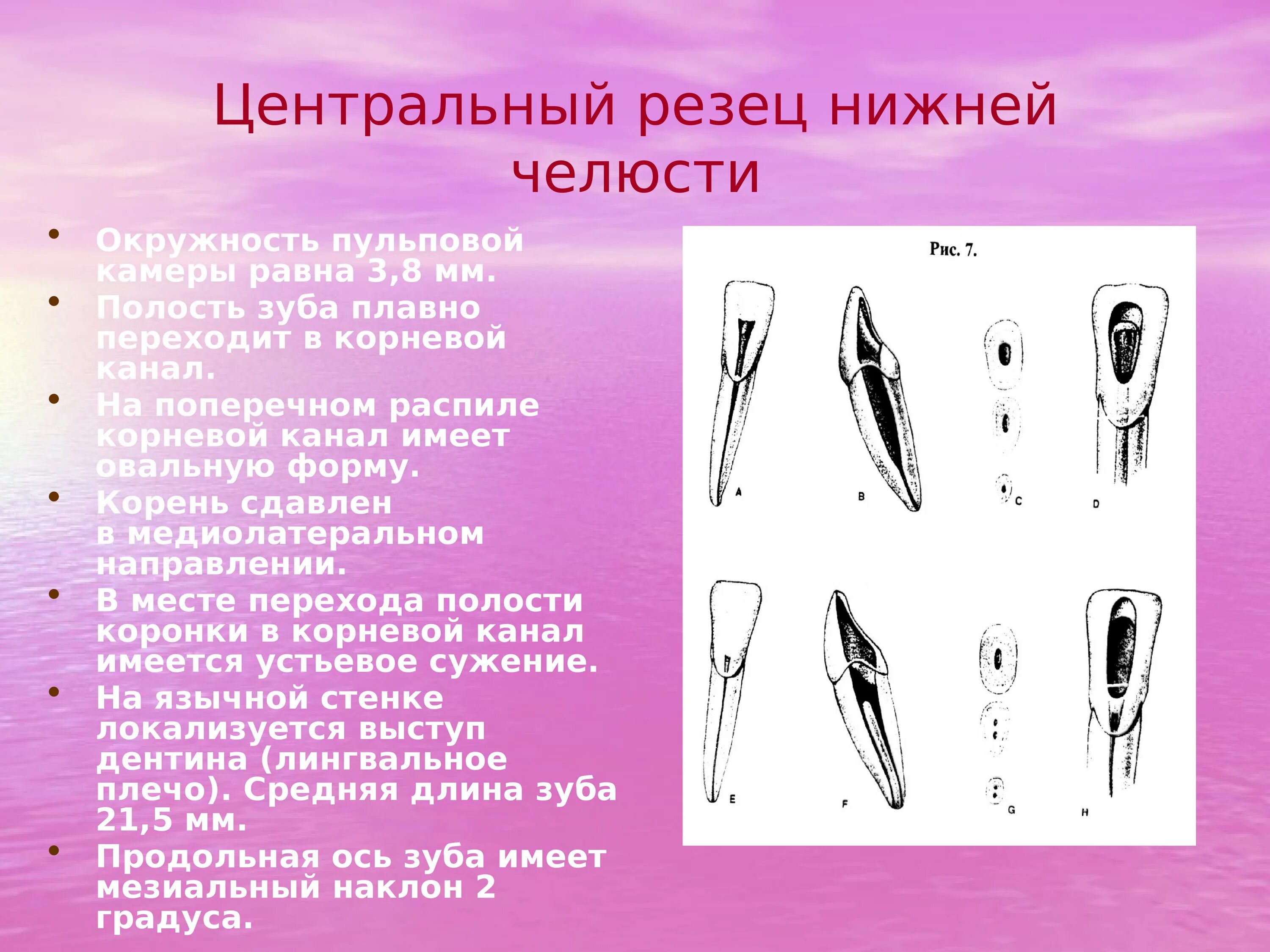 Боковой резец нижней челюсти анатомия. Центральный медиальный резец верхней челюсти. Латеральный резец нижней челюсти анатомия. Латеральныйрезец нижней челюстиъ. Формы корневых каналов