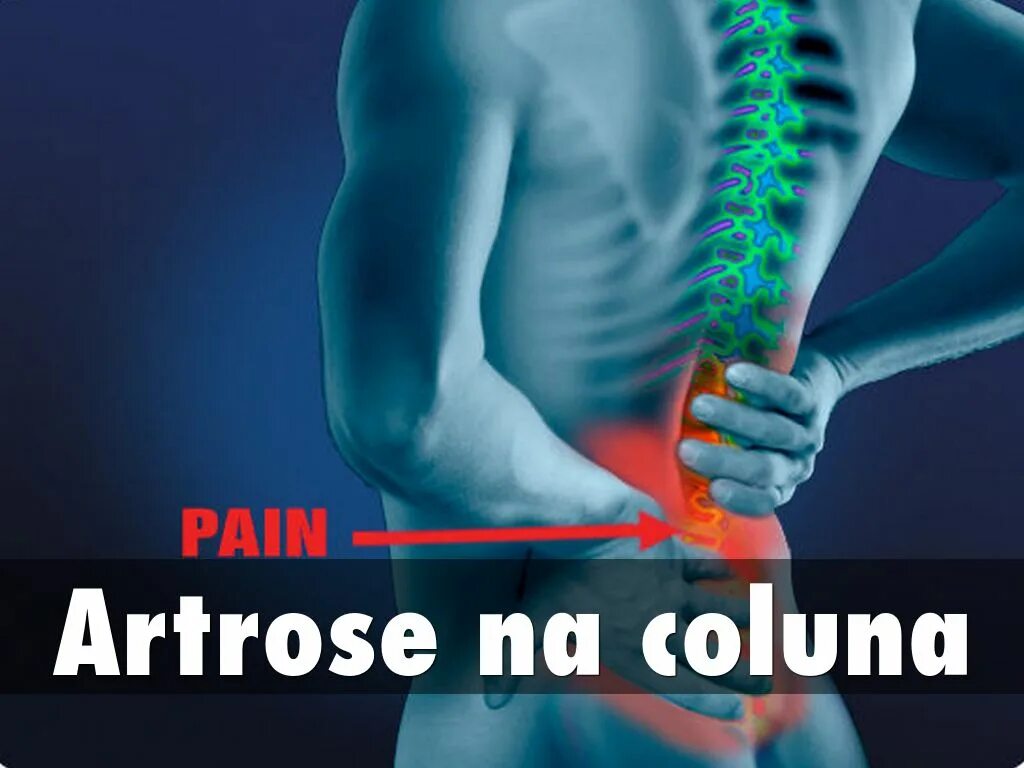 Покалывание в пояснице. Онемения от позвоночника. Lower back Pain treatment. Lower back Pain Gym. Leg numbness backache relieve Lumbar Spondylitis toctherb.