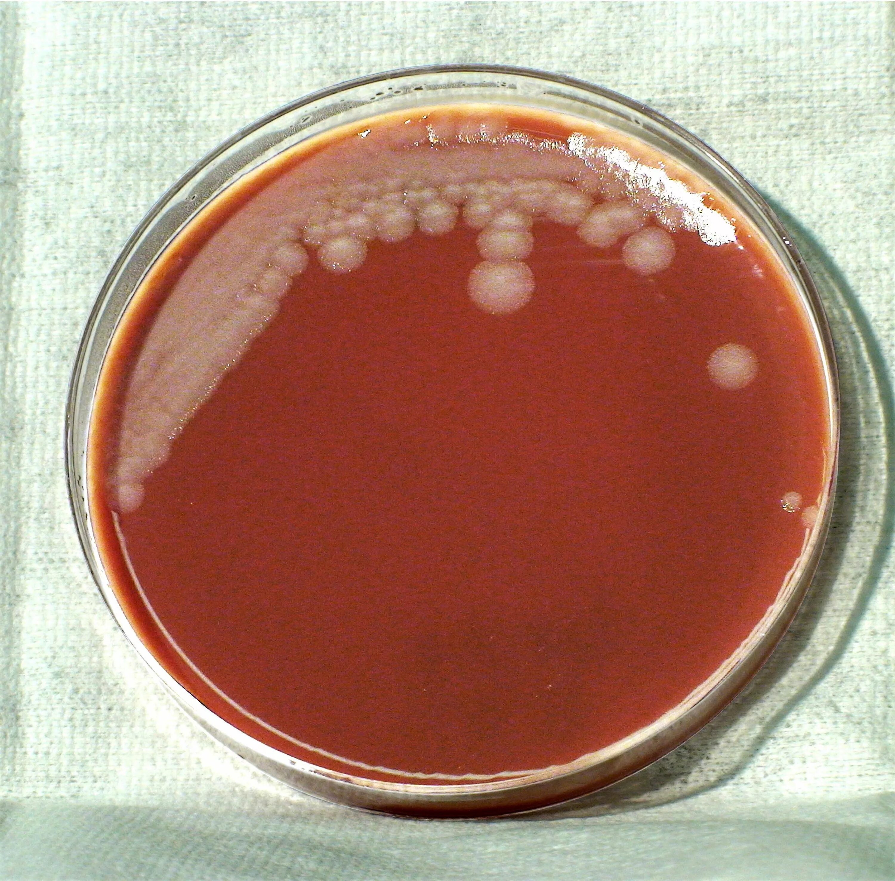 Ба агар. Bacillus anthracis Сибирская язва. Bacillus anthracis культивирование.