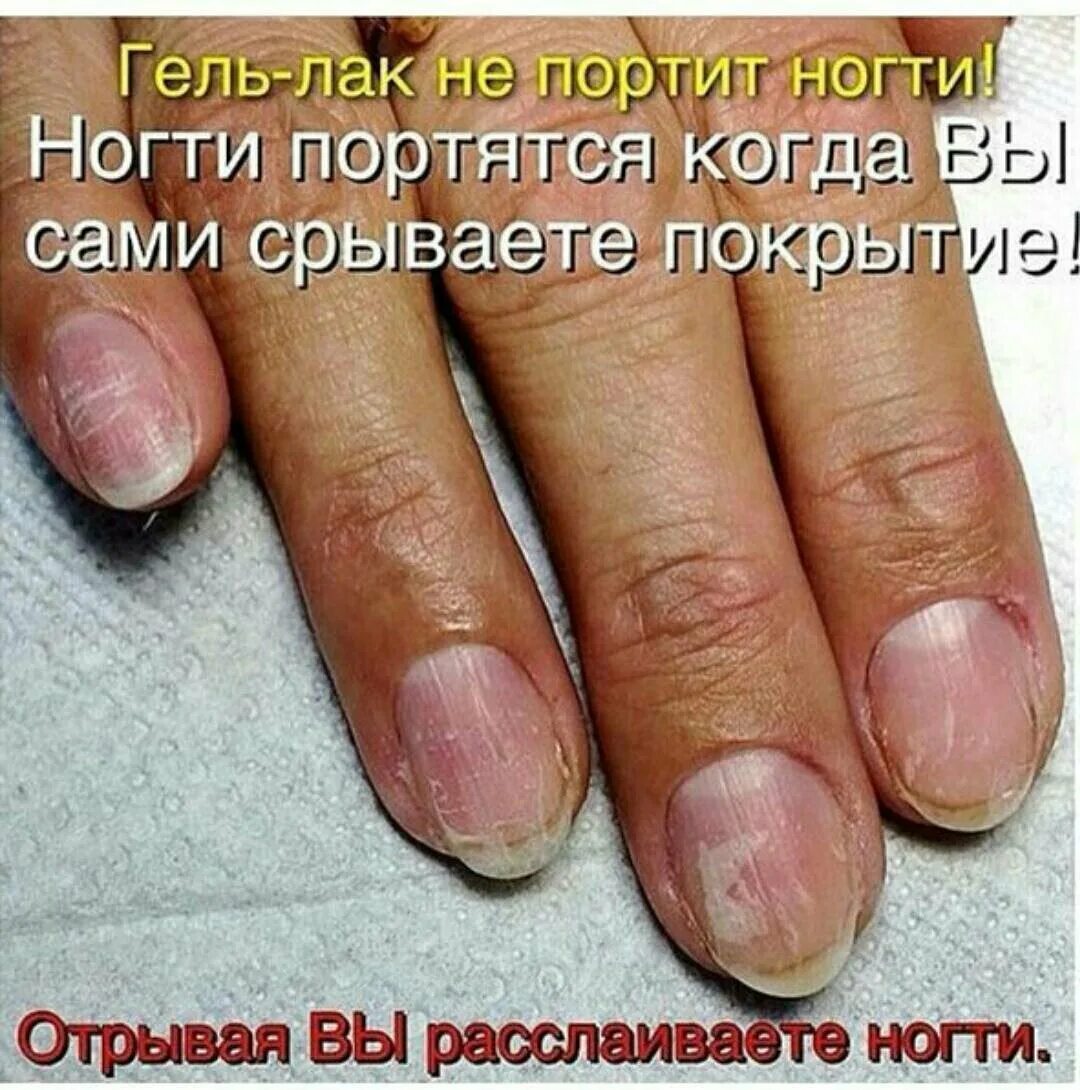 Содранное покрытие с ногтей. Что делать с ногтями после