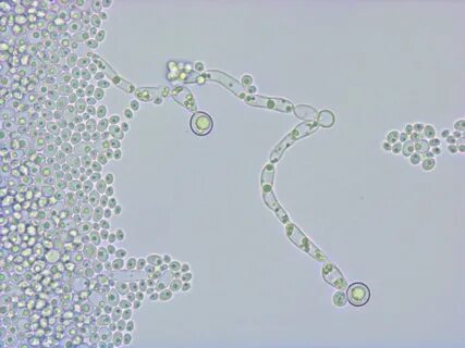 Candida albicans 10 5