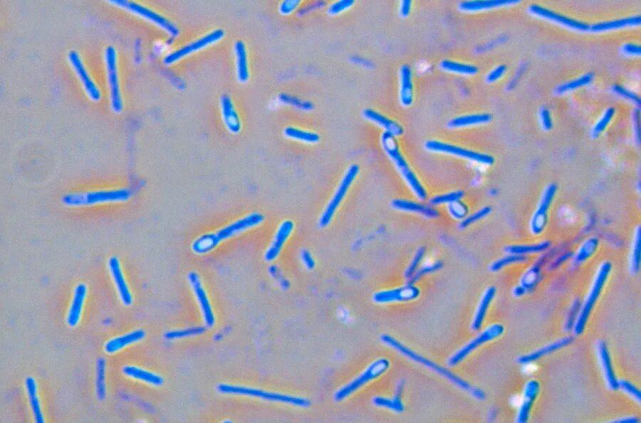 Clostridium spp. Клостридии ботулизма ( Clostridium botulinum ) ботулизм. Морфология клостридии перфрингенс. Клостридия ботулизма бактерия. Clostridium perfringens микробиология.