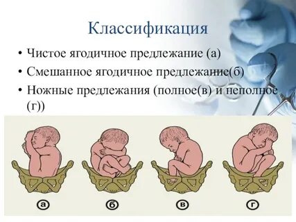 Лицевое предлежание