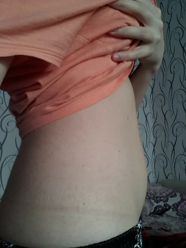 Живот на 9 неделе беременности. Живот на 10 неделе с двойней. Животы беременных двойней. Животами 9. Живот на 8 акушерской неделе.