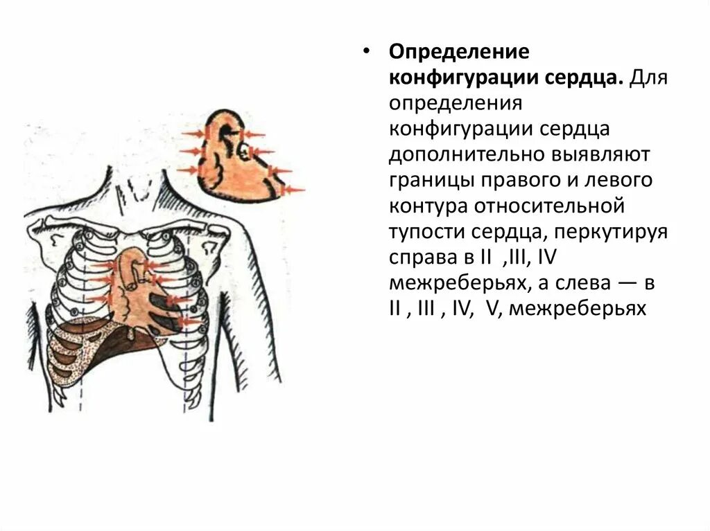 Определение сердечно