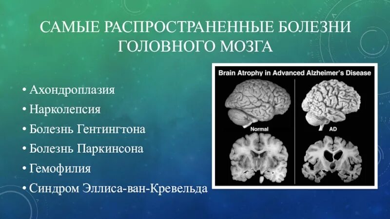 Заболевание мозга название. Заболевания головного мозга список. Патология головного мозга.