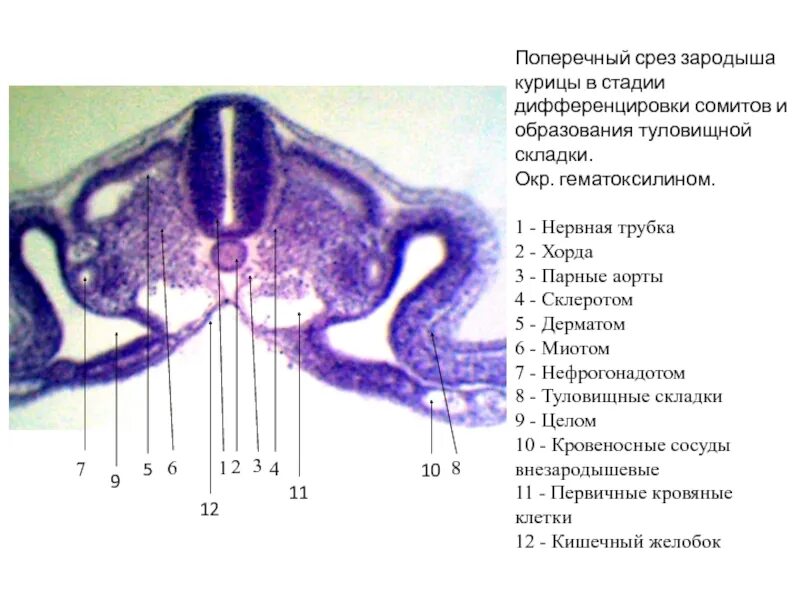 Зародыш курицы образование туловищных складок. Поперечный срез зародыша гистология. Мезенхима поперечный срез зародыша курицы. Мезенхима срез зародыша курицы.