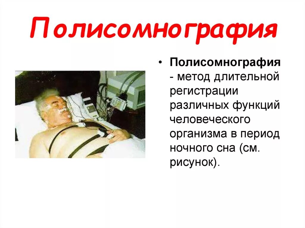 Полисомнография. Полисомнография. Исследование полисомнография. Полисомнография датчики. Полисомнография датчики.