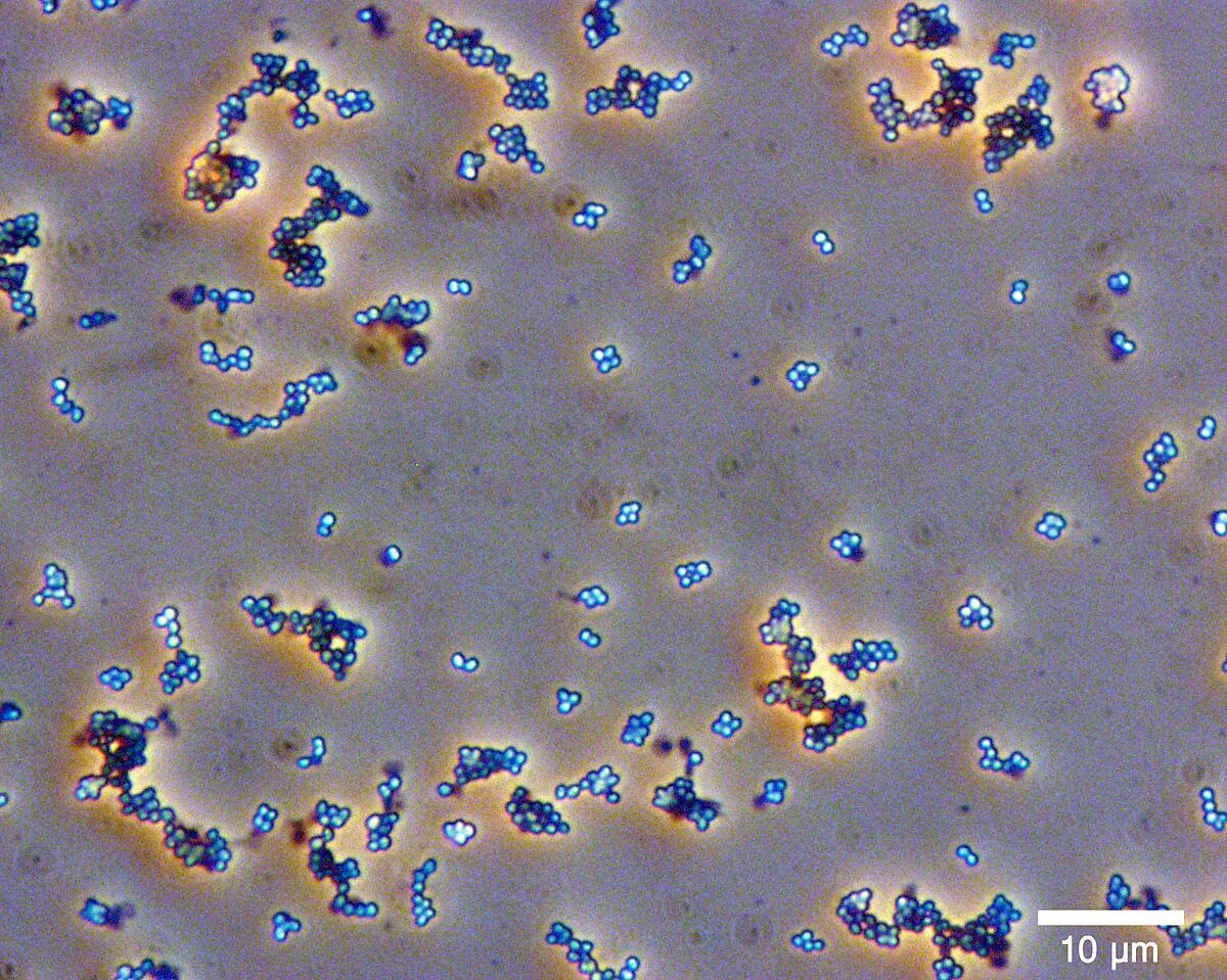 Micrococcus luteus микроскоп. Микрококки Лютеус. Micrococcus luteus препарат. Micrococcus luteus окраска по Граму. Rothia mucilaginosa