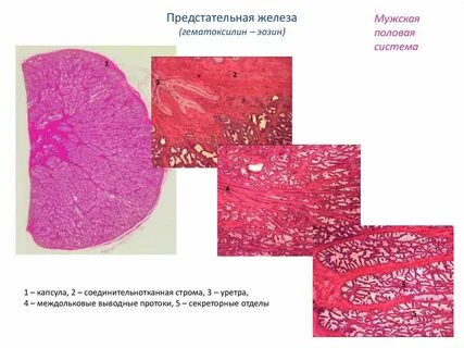 Железы простаты