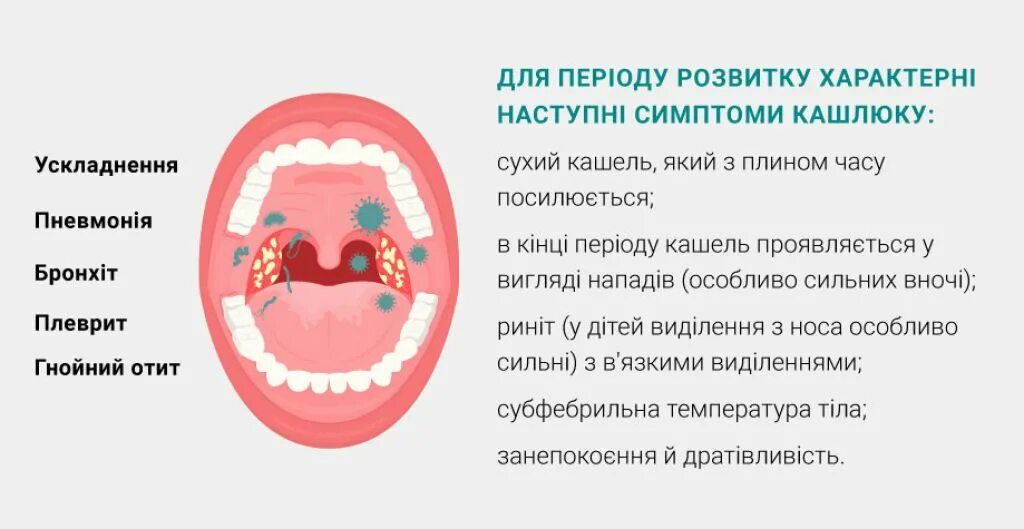 Температура горло болит мокрота. Горло при коклюше у детей. Коклюш ротовая полость.