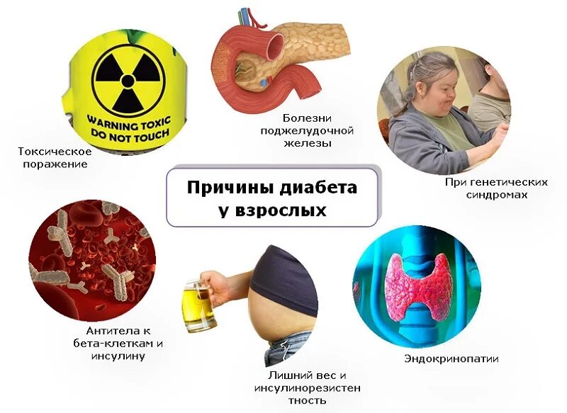 Факторы провоцирующие возникновения сахарного диабета. Причина появления сахарного диабета у взрослых. Причины развития сахарного диабета. Факторы способствующие возникновению сахарного диабета. Сильные боли сахарном диабете