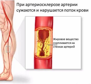 От вен сосуды