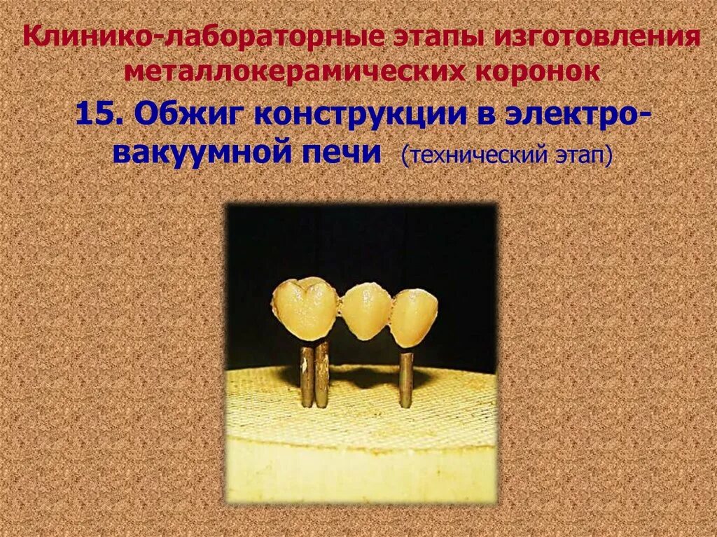 Обжиг коронки. Обжиг коронки. Клинико лабораторные этапы керамической коронки. Нанесение опака на металлокерамику. Моделировка каркаса под металлокерамику.