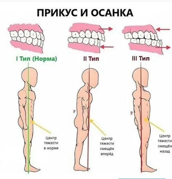 правильная осанкаосанка.