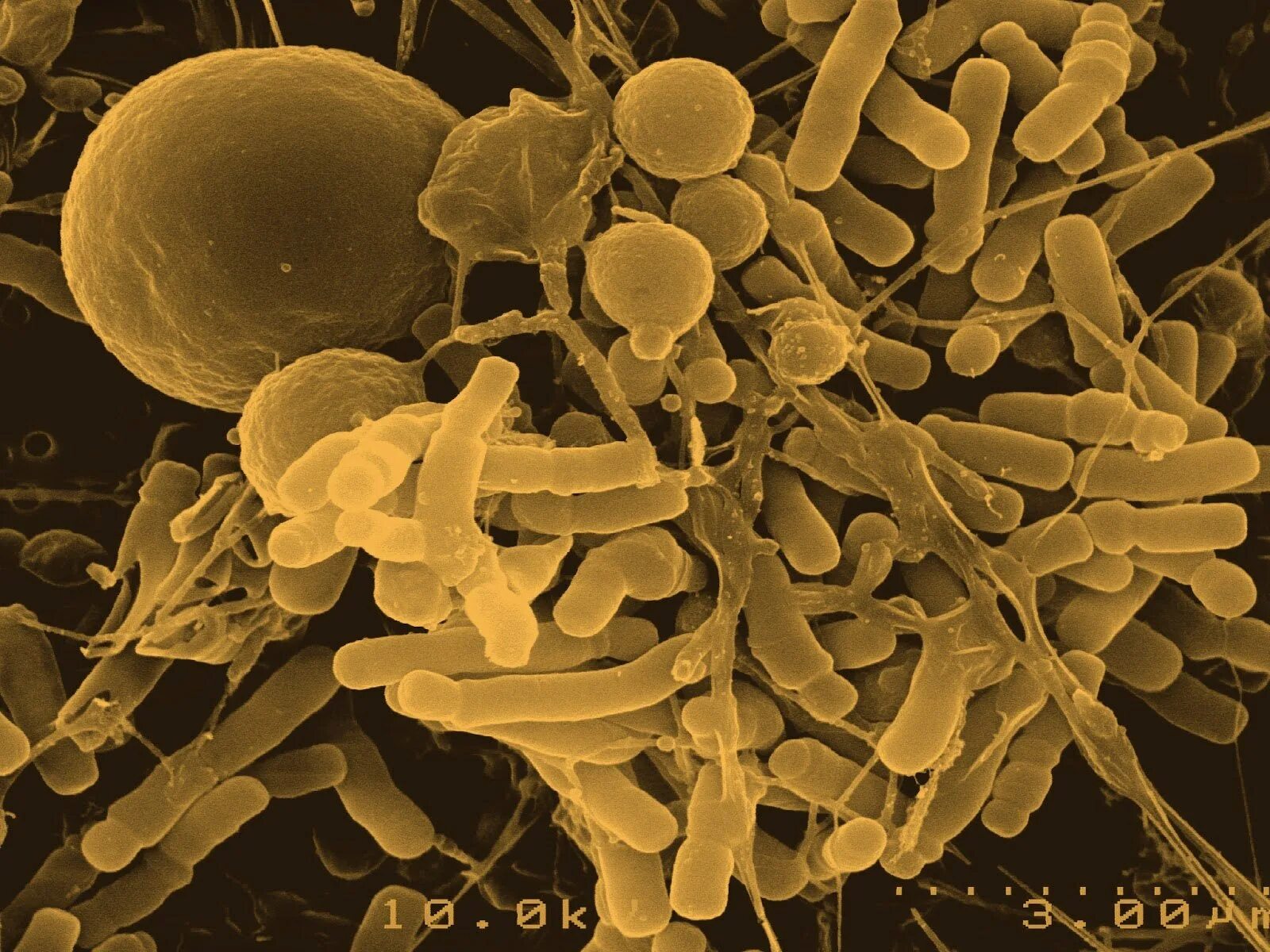 Палочка бифидобактерии. Бифидобактерии бифидум микроорганизмы. Бифидобактерии longum. Бифидобактерии лонгум 35624. Бактерии рода Bifidobacterium longum.