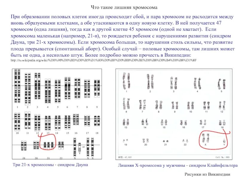 Синдром лишней хромосомы. Почему бывает лишняя хромосома. Наличие лишней хромосомы