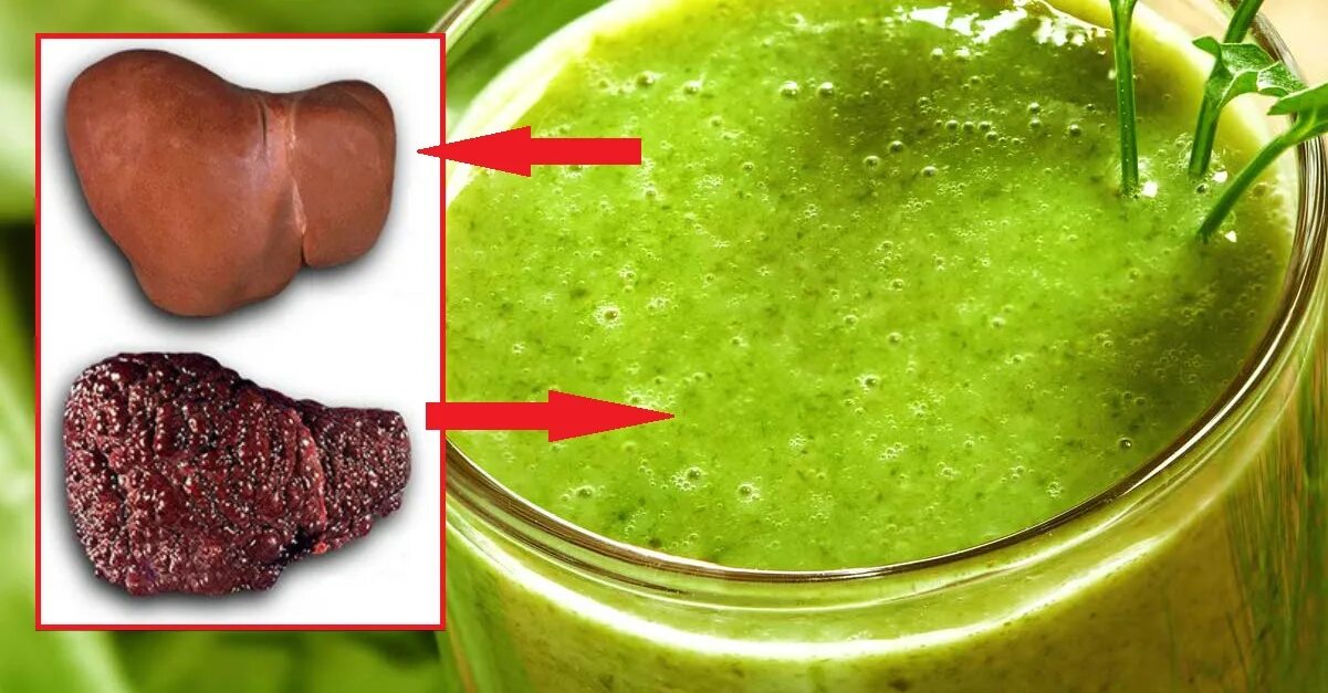 Очищение печени от шлаков и токсинов. Очищение печени от шлаков. Очищение печени от шлаков. Очищение печени от шлаков. Чистка печени схема.