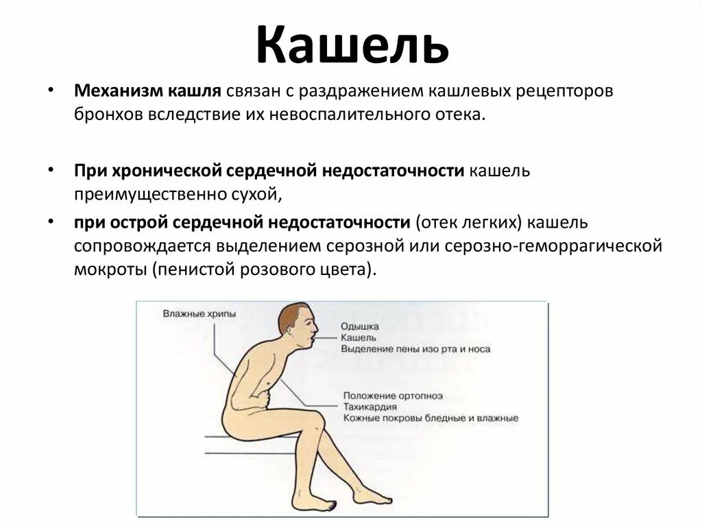 Кашель при сердечной недостаточности. Механизм кашля при сердечной недостаточности. Покашливание при сердечной недостаточности. Сердечная недостаточность кашель. Дыхание при сердечной недостаточности