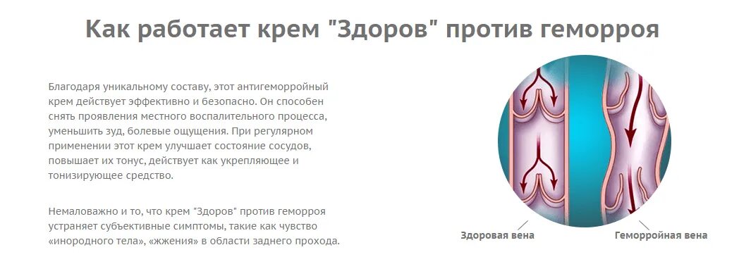 Эффективные методы лечения геморроя. Средство от геморроя. крем против геморроя.