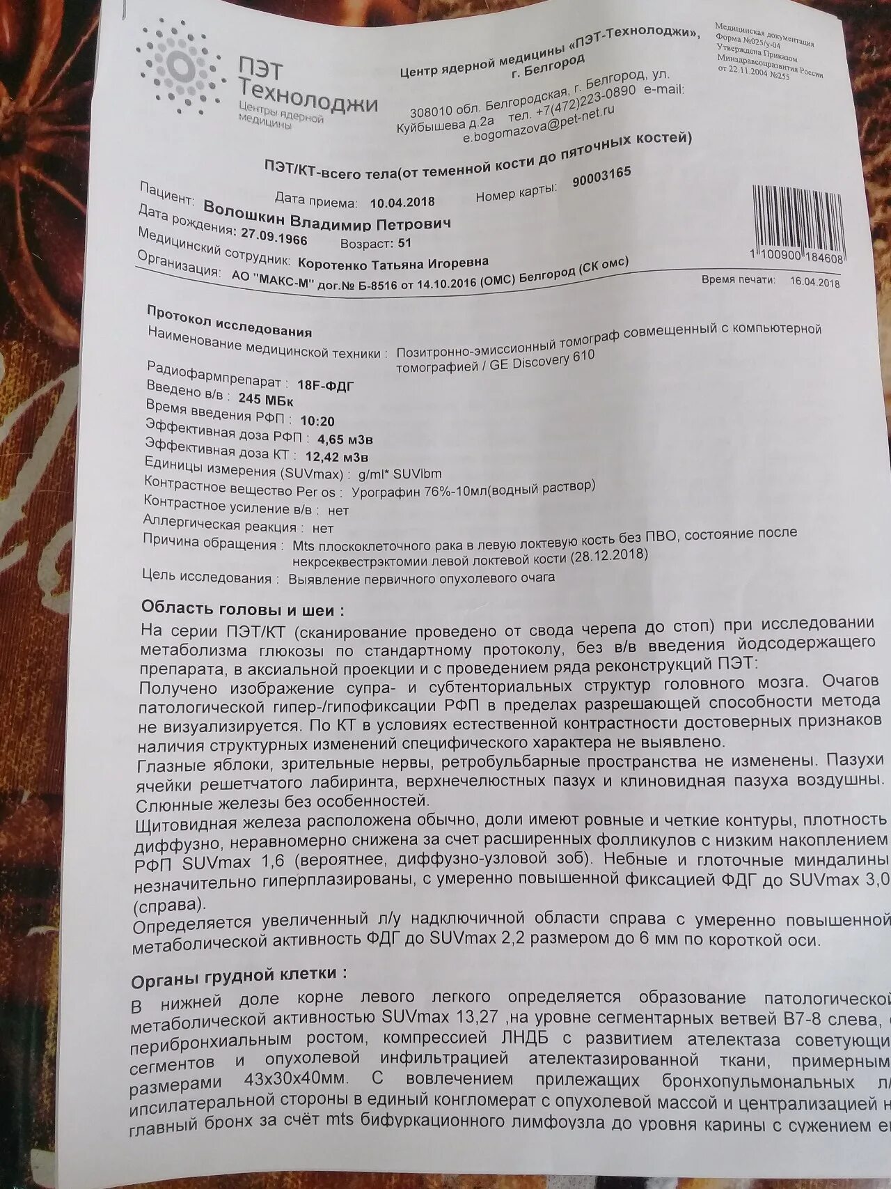 Что значит метаболическая активность. Очаг повышенной метаболической активности ФДГ. Метаболическая активность ФДГ что это такое. Повышенная метаболическая активность ФДГ что это. Очаг метаболической активности что это.