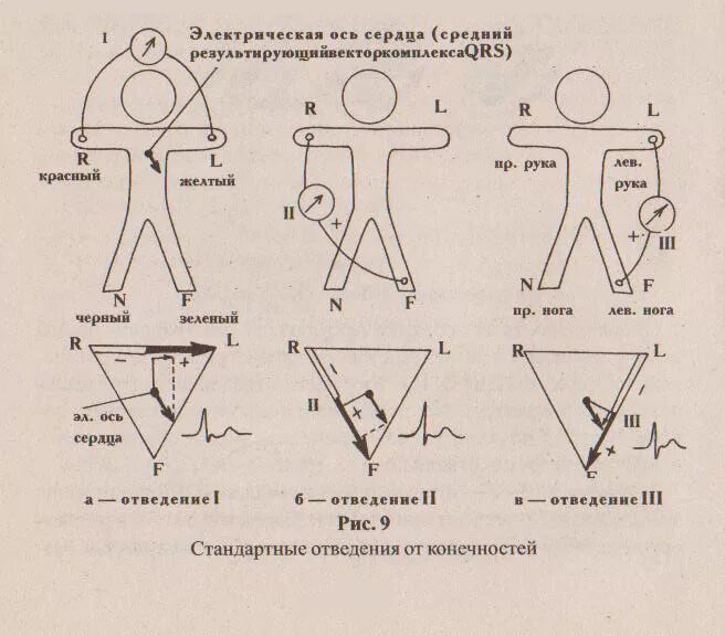 Стандартные усиленные и грудные отведения экг. 2 стандартное отведение. Стандартные отведения при экг. Отведения i ii ii. 2 стандартное отведение экг наложение электродов.