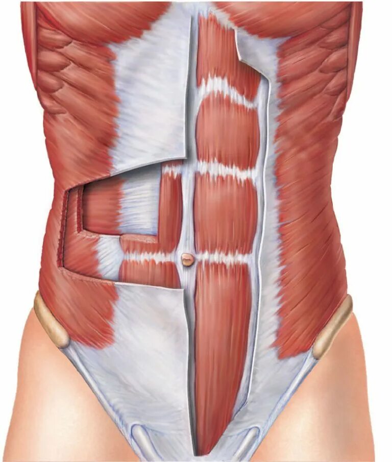 Передняя часть живота. Апоневроз косой мышцы живота. Апоневроз наружной мышцы живота. Прямая мышца живота анатомия. Пирамидальная мышца живота.
