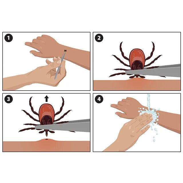 To further remove
