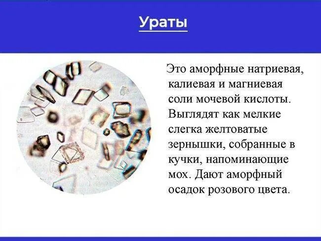 Беременность фосфаты