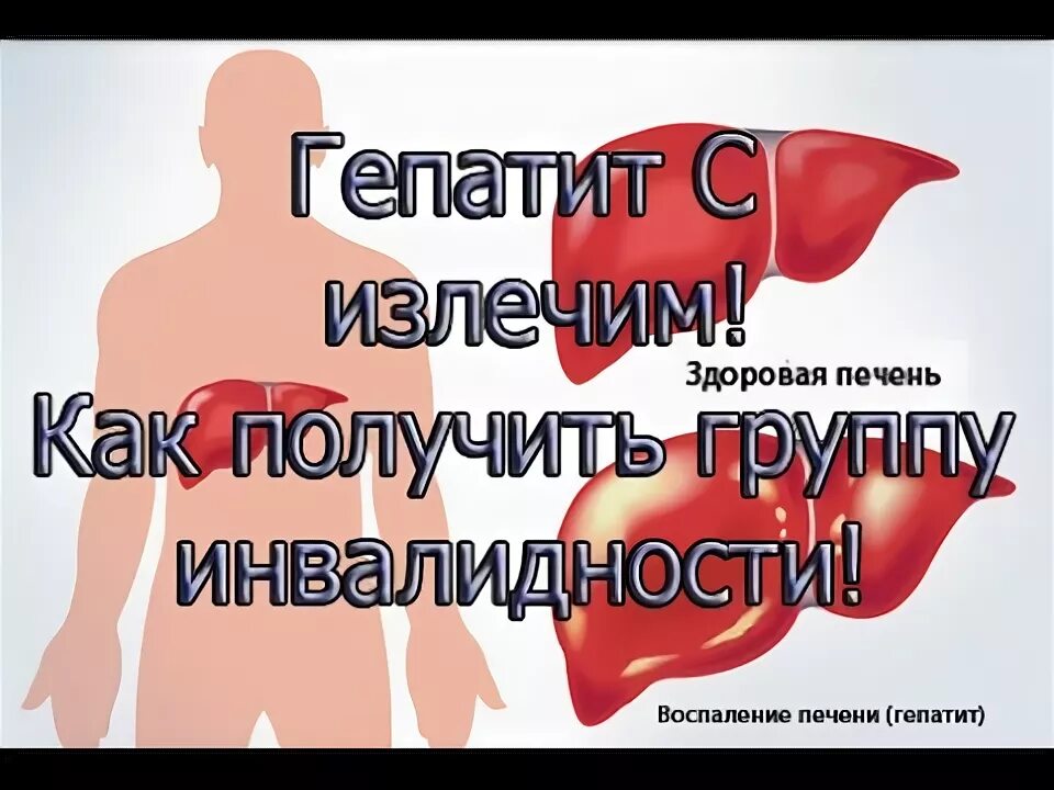 Гепатит с излечим. Инвалидность при гепатите. Дают ли инвалидность при ВИЧ И гепатите с. Дают ли инвалидность при гепатите б.