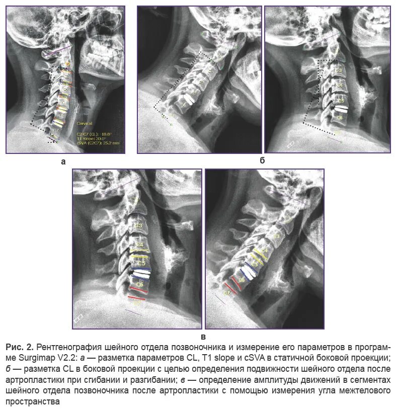 Рентген пояснично крестцового отдела позвоночника как делают. Рентген пояснично крестцового отдела позвоночника как делают. Рентген пояснично крестцового отдела позвоночника как делают. Рентген позвоночника крестец. Рентген пояснично крестцового отдела позвоночника как делают.
