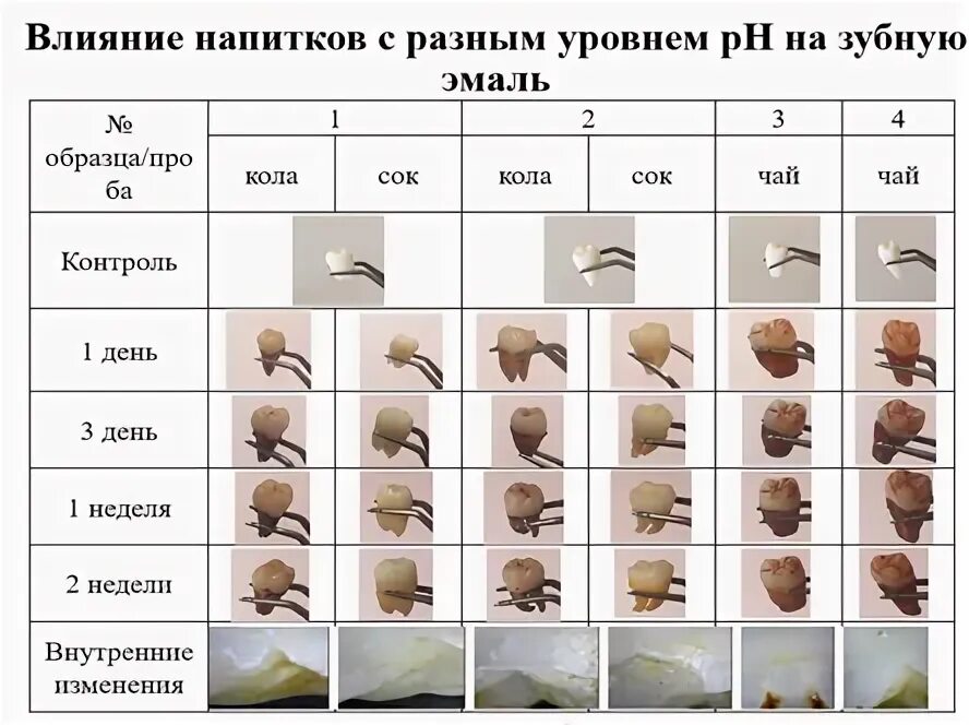Влияет на зубную эмаль на. Влияние газированных напитков на зубы. влияние напитков на зубную эмаль. влияние газировки на зубную эмаль. влияние напитков на зубную эмаль опыт.