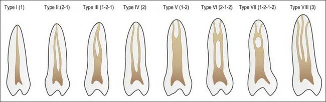 Типы корневых каналов по Vertucci. Классификация корневых каналов Vertucci 1984. Классификация Vertucci. Классификация корневых каналов по Вейне. Формы корневых каналов