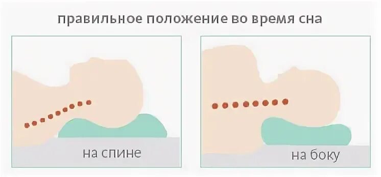 Правильное положение головы во время. Правильное положение шеи и головы. Правильное положение тела во время сна. Положкние ше во вре я сна. Правильное положение подушки при сне.