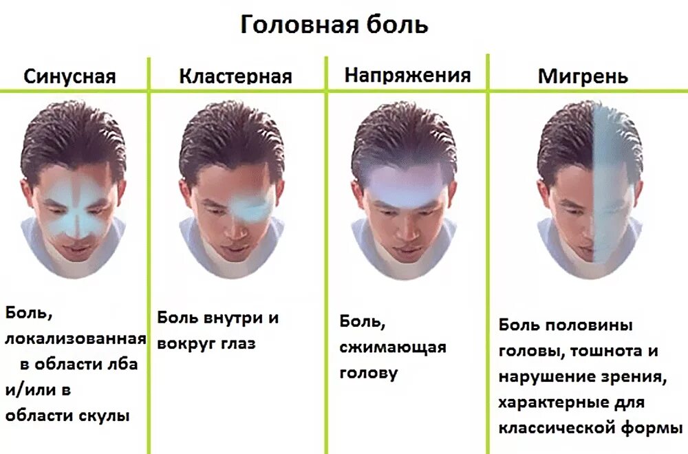 При поворотах головы кружится голова причины. Типы головной боли по локализации. Головная боль локализация. Причины головной боли. Локализация головной боли и причины.