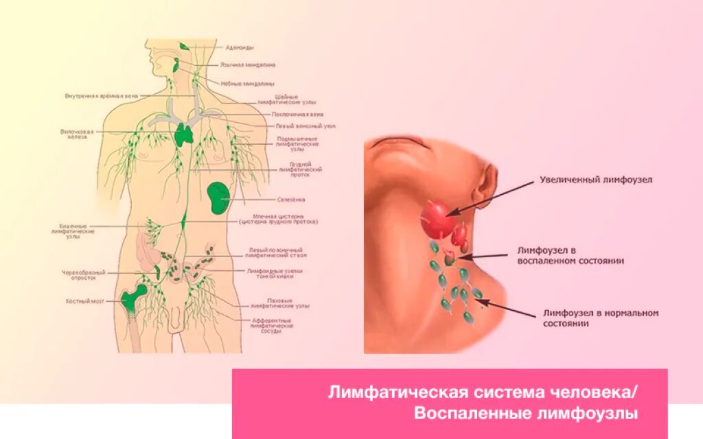 Тонзиллярные лимфоузлы. Воспаления лимфа лимфоузлы. Лимфатические узлы на теле человека схема шейные. Регионарные шейные лимфоузлы.