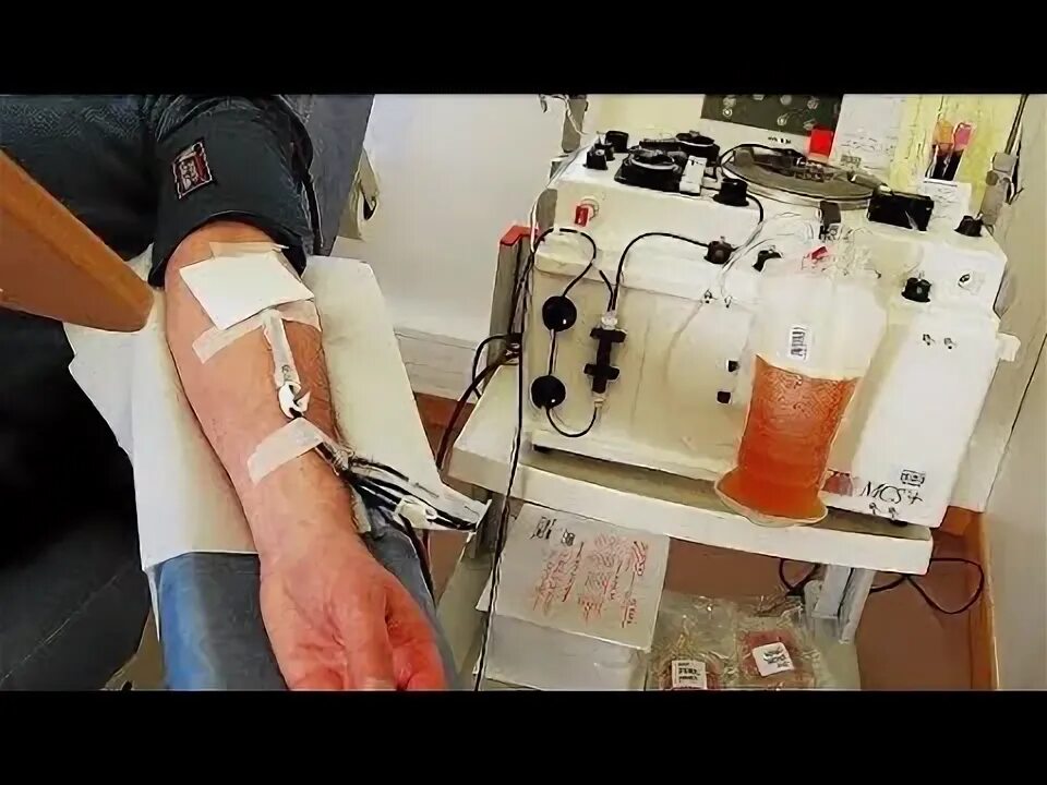 Плазмаферез. Плазмаферез. Haemonetics плазмаферез. Плазмаферез. Процесс отделения плазмы.