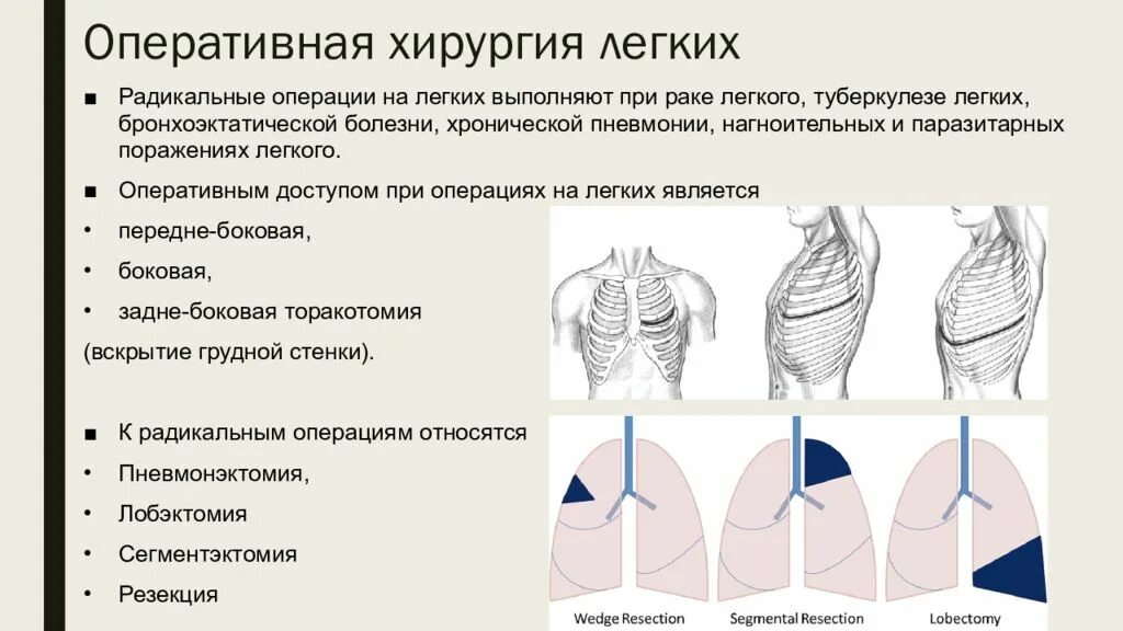 Торакотомия. Оперативные доступы к легким.. Оперативные вмешательства при бронхоэктатической болезни. Оперативный доступ при резекции легкого. Доступы при операциях на легких.