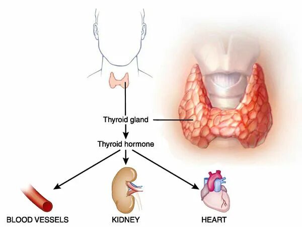 Гипертиреоз щитовидной железы. Щитовидка тиреотоксикоз. Гипертиреоз, зоб щитовидной железы.