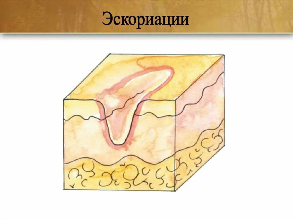 Строение и функции кожи 9 класс презентация. Строение кожи рисунок.