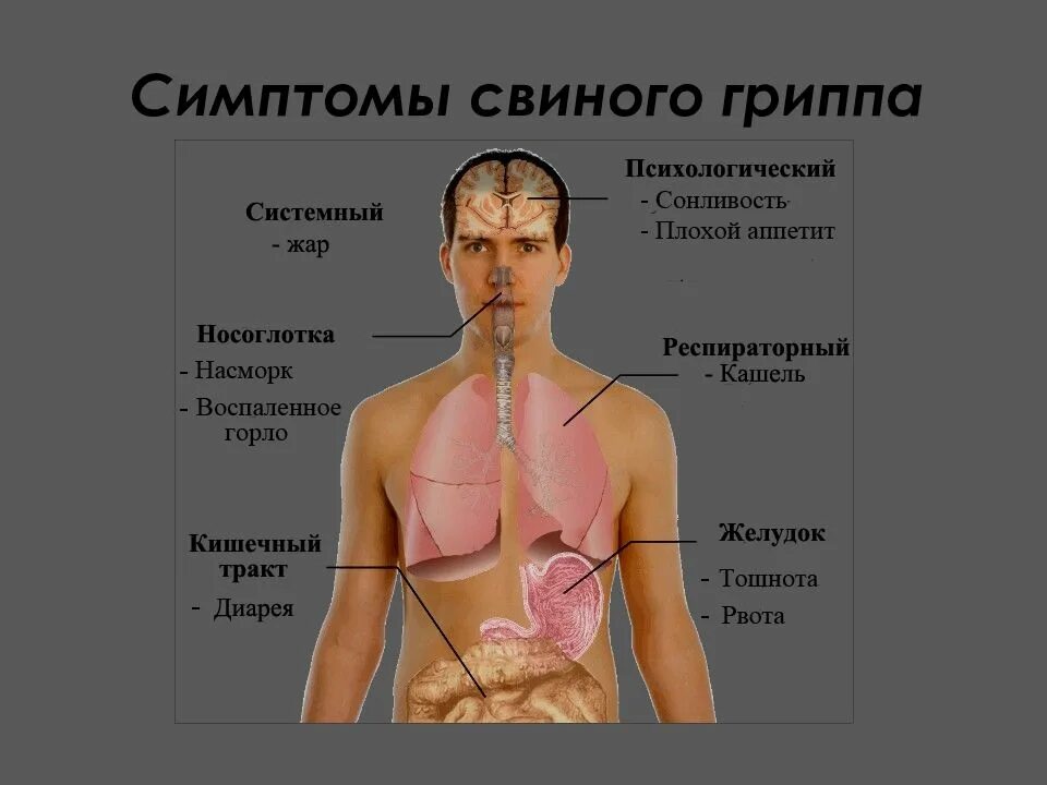 Грипп на данный момент. Свиной грипп h1n1. симптомы свиноготгриппа. симптомы свинногогриаппа. симптомы гриппа.