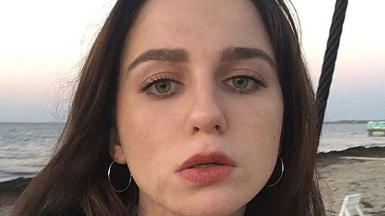 Света уголек модель с ожогами. Света уголек — модель с ожогами 45 % тела. Света уголек — модель с ожогами 45 % тела. Светой уголек. Света уголек модель с ожогами.