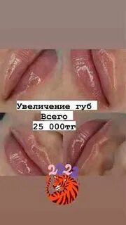 Үлкен вагинальды еріндердің фотосуреттері