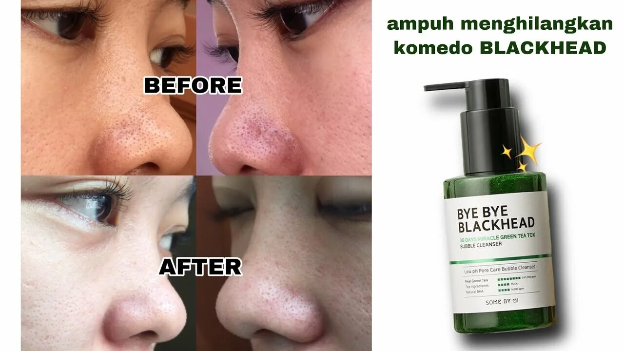 B project bye blackhead melting remover. Some by mi Bye Bye Blackhead 30 Days Miracle Green Tea Tox Bubble Cleanser. Some by mi Bye Bye Blackhead. Some by mi Bye Bye Blackhead Bubble Cleanser. Bye Bye Blackhead от черных точек.