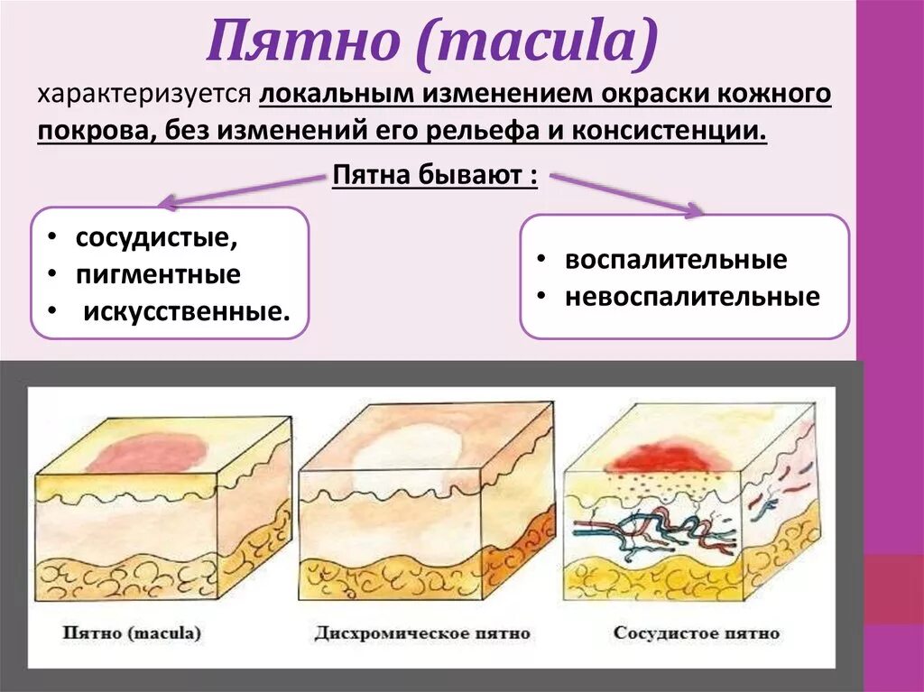 Вторичные элементы поражения