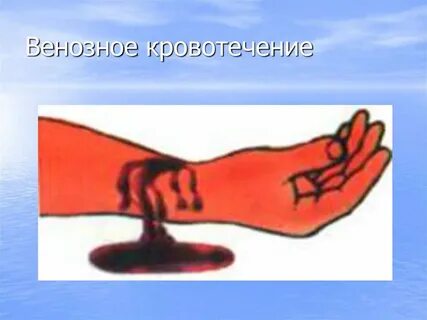 Венозное течение