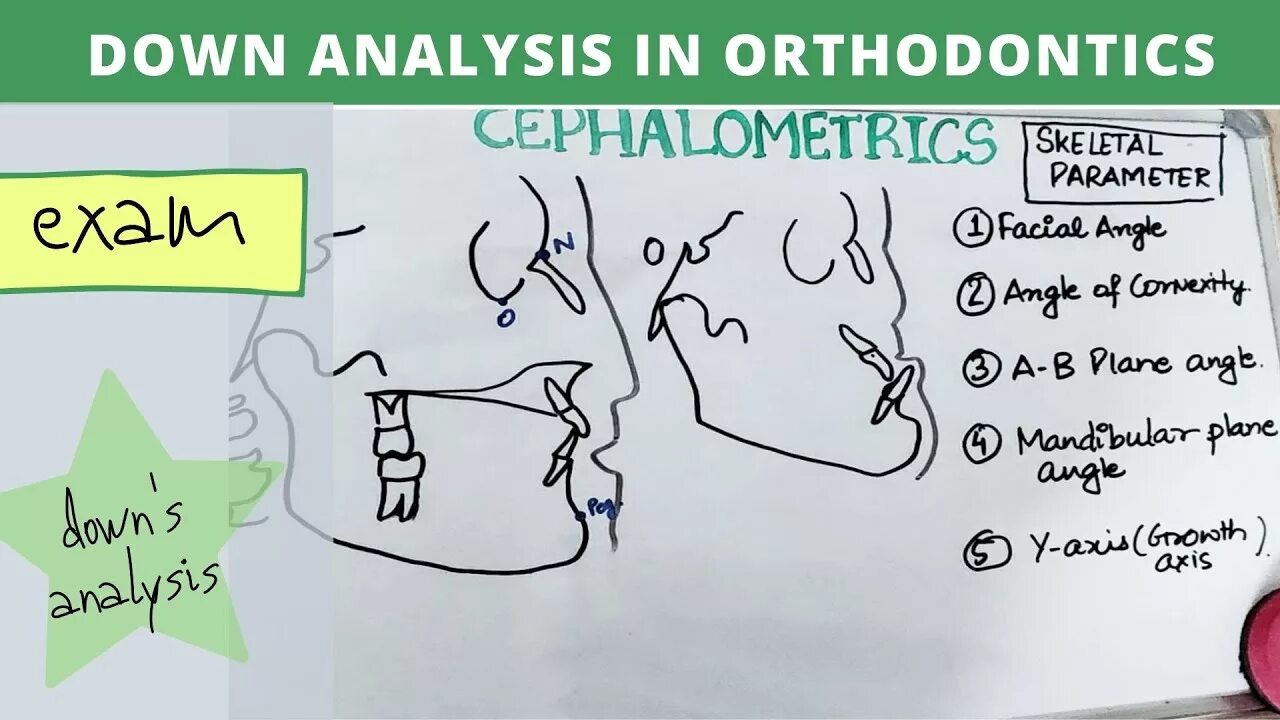 Downs analysis. Orthodontic cephalometric analysis.