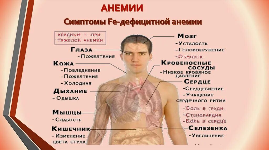 Пост при анемии. Боль в сердце при анемии. Боль в груди при анемии. Головокружение при анемии.